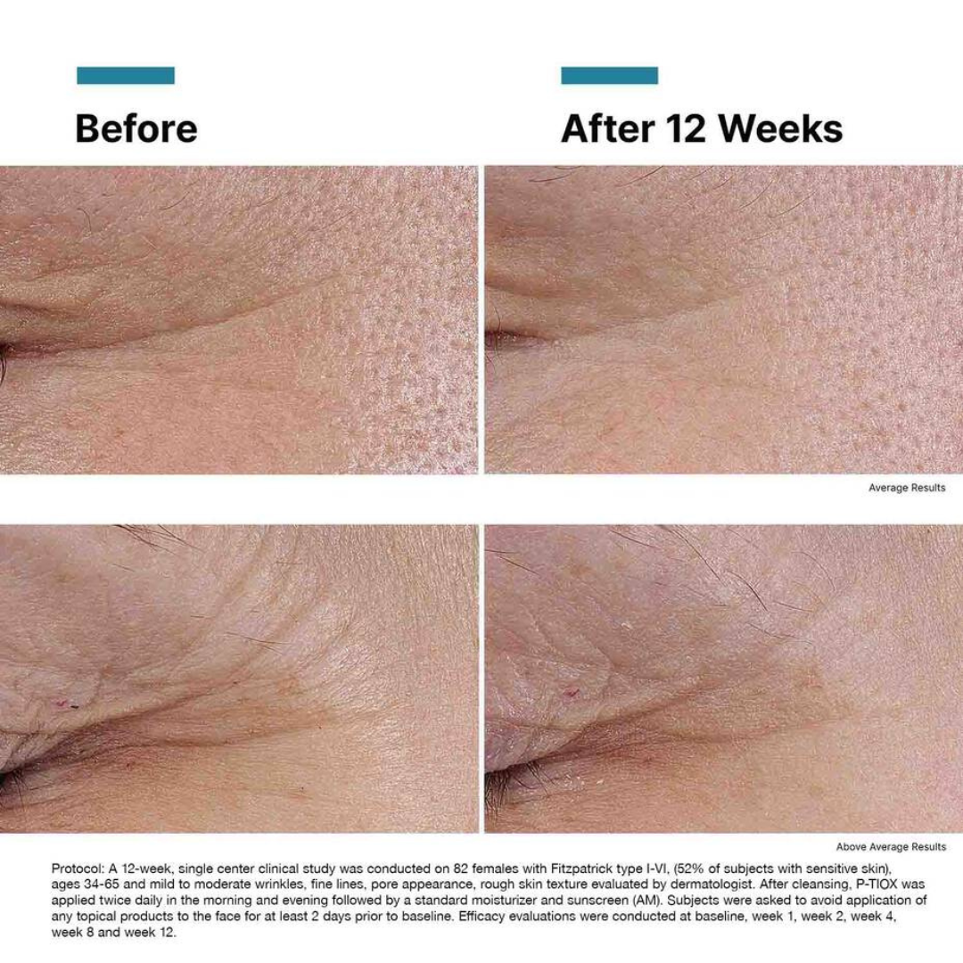P-TIOX Peptide Serum